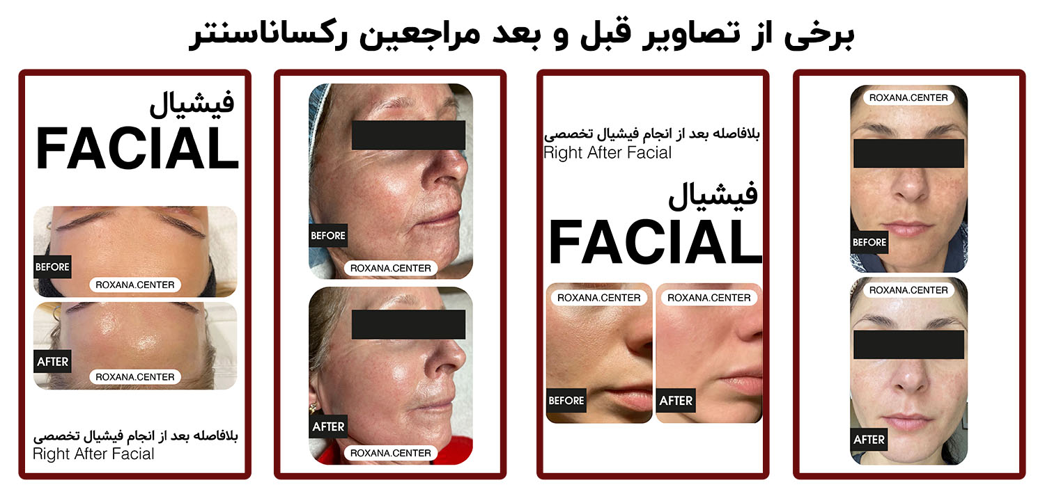 فیشیال | رکساناسنتر