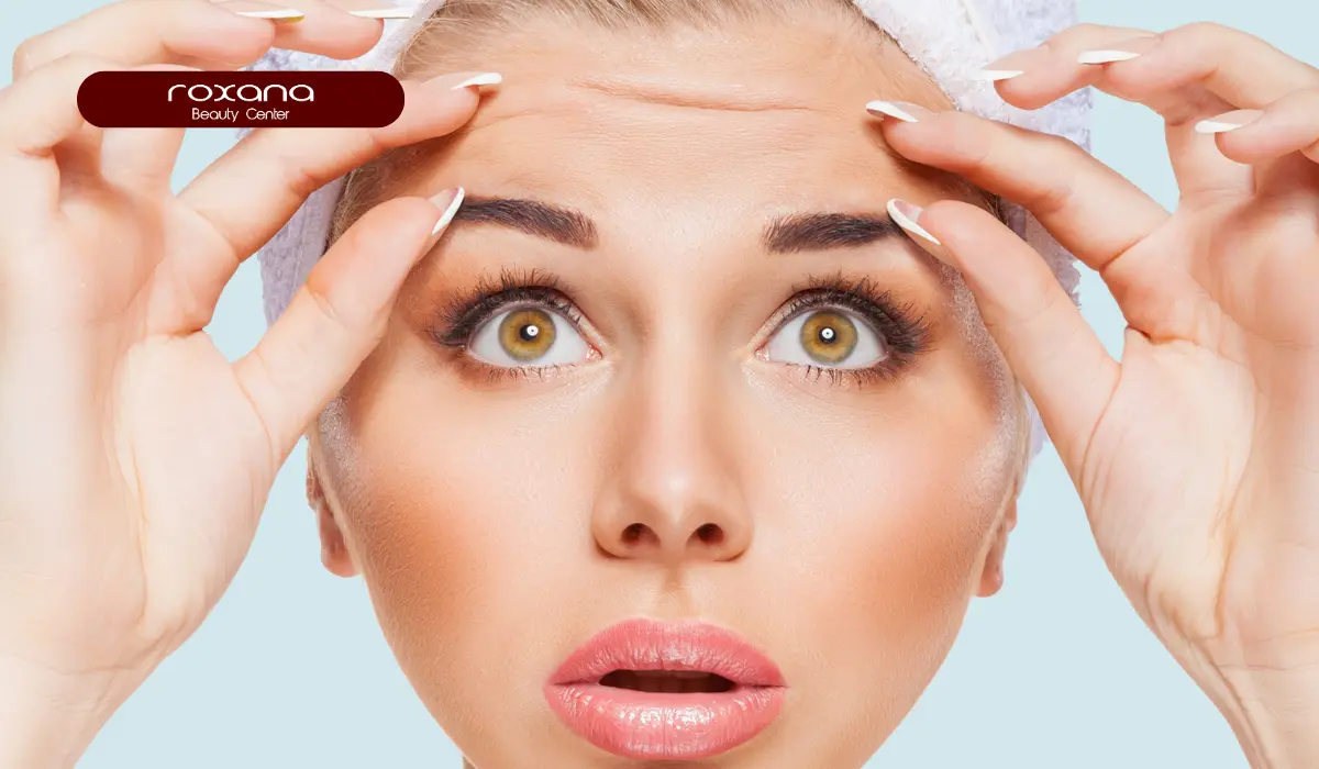 فیشیال بعد از بوتاکس