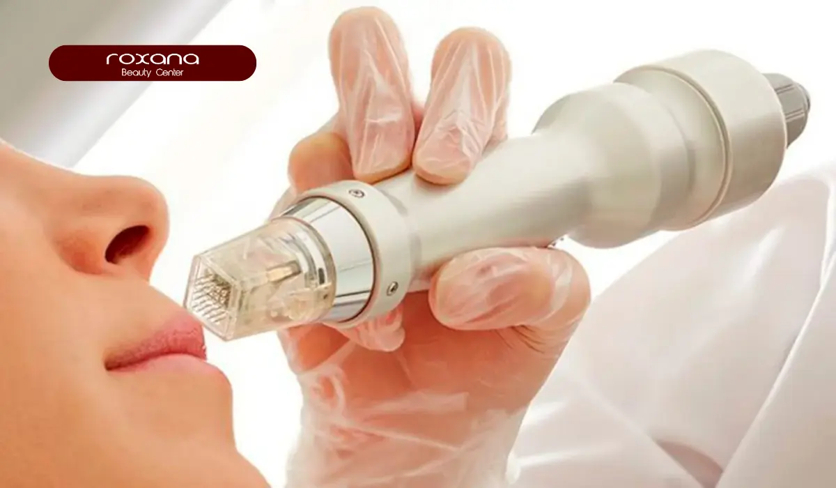 بهترین مرکز آر اف فرکشنال در تهران