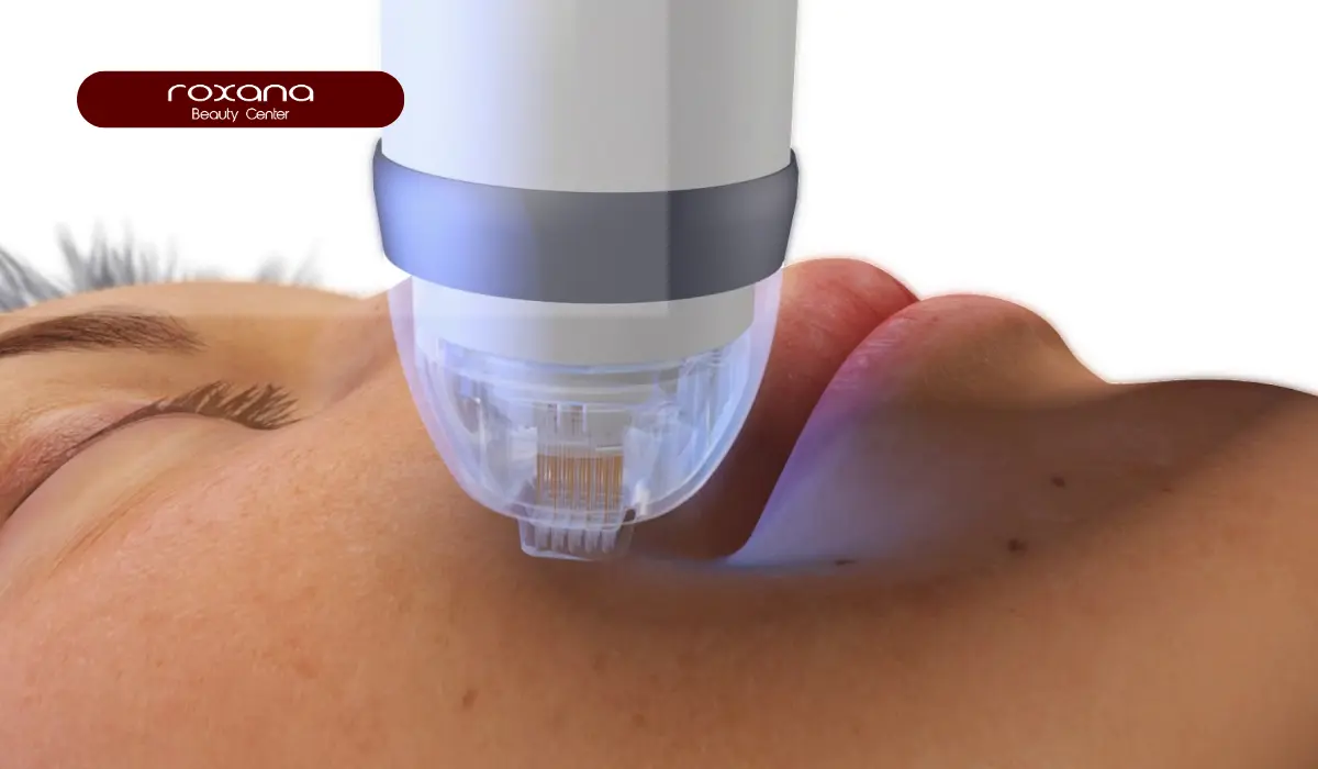 بهترین دستگاه لیزر co2 فرکشنال