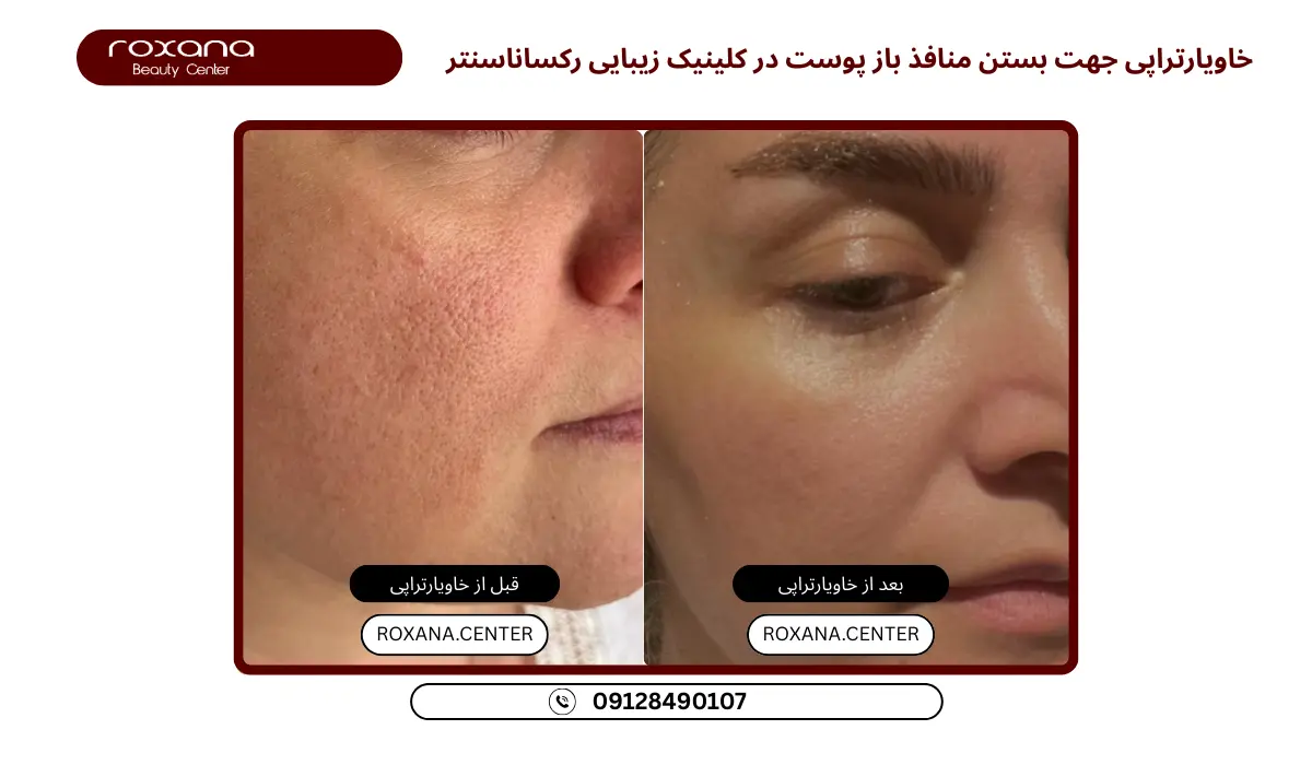 قیمت خاویارتراپی تهران