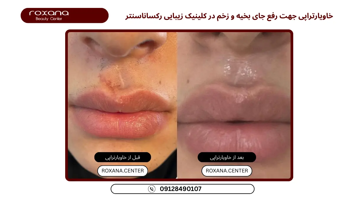 بهترین مرکز خاویارتراپی تهران